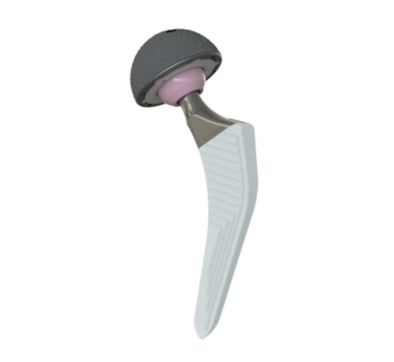 hip replacement